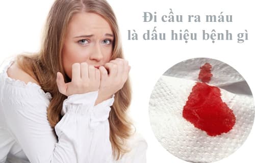 Đi cầu ra máu là bệnh gì